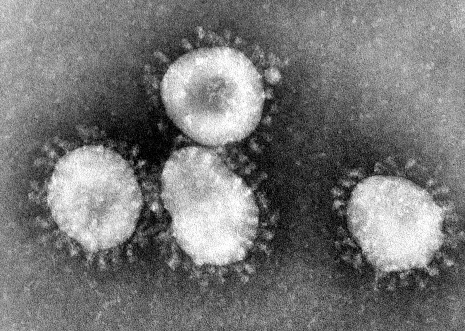 Photo du virus SARS-CoV