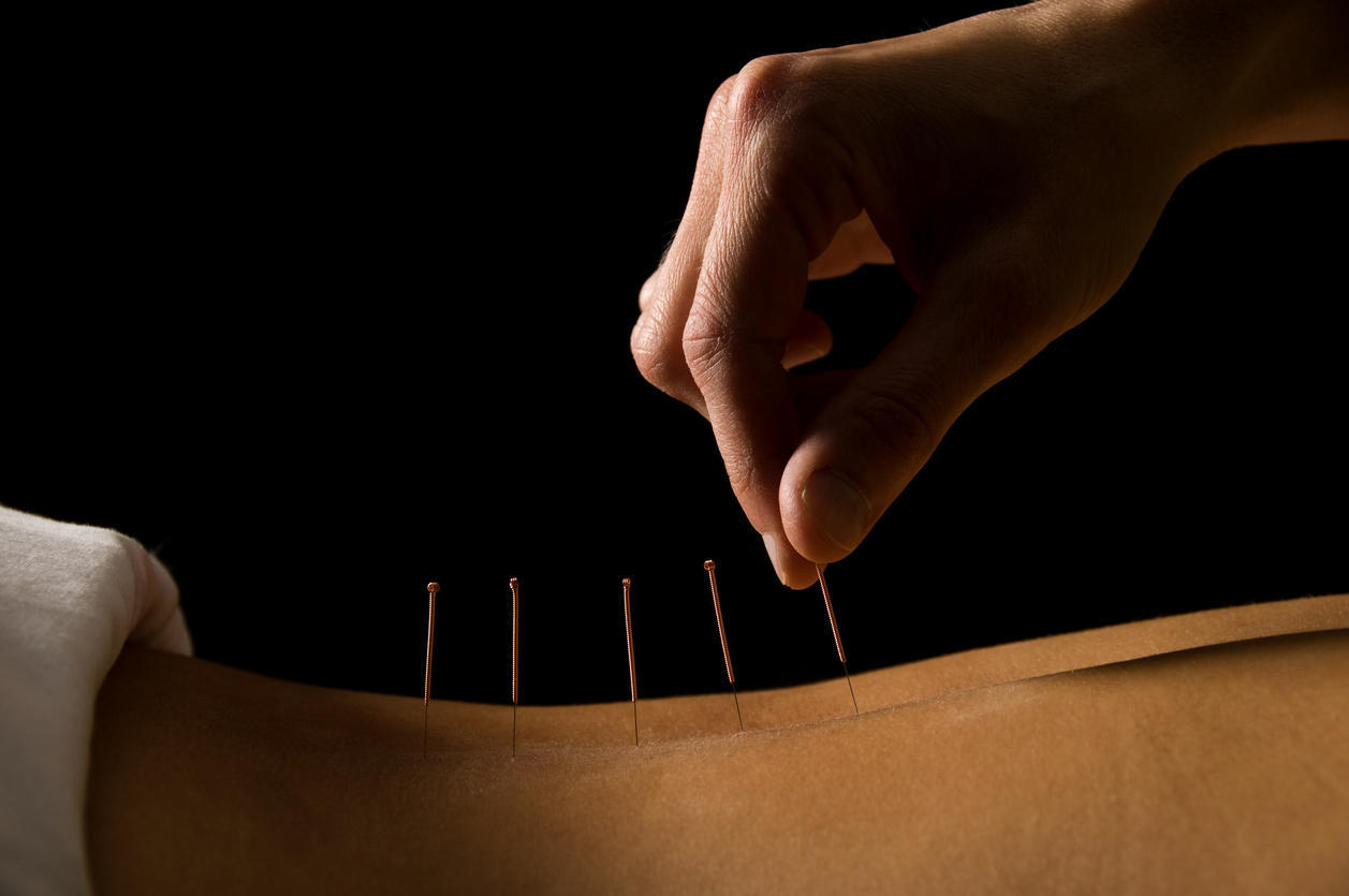combien faut il de seance acupuncture pour maigrir