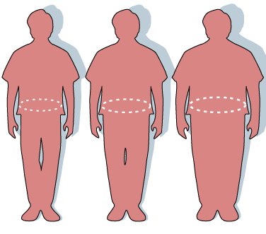 Quelles sont les conséquences de l'obésité et du surpoids ?