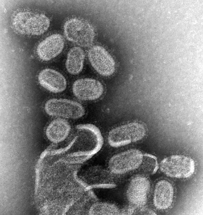 Qu'est-ce que le virus influenza ?