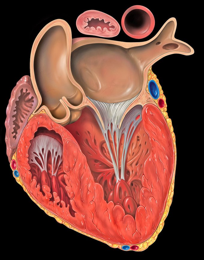 Qu&apos;est-ce que l&apos;infarctus du myocarde?