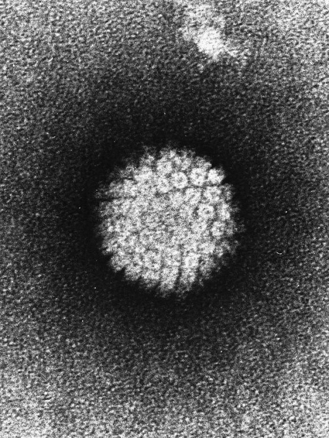 Photo : HPV au microscope électronique