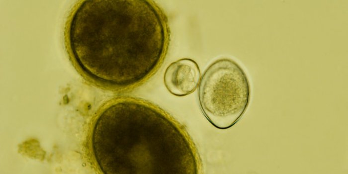 two eggs of toxocara cati and two oocysts of isospora felis under the microscope
