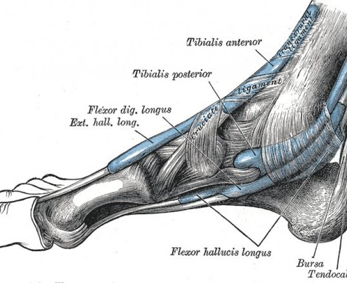 Hallux rigidus (arthrose du gros orteil) : quelle operation pour le soigner ?