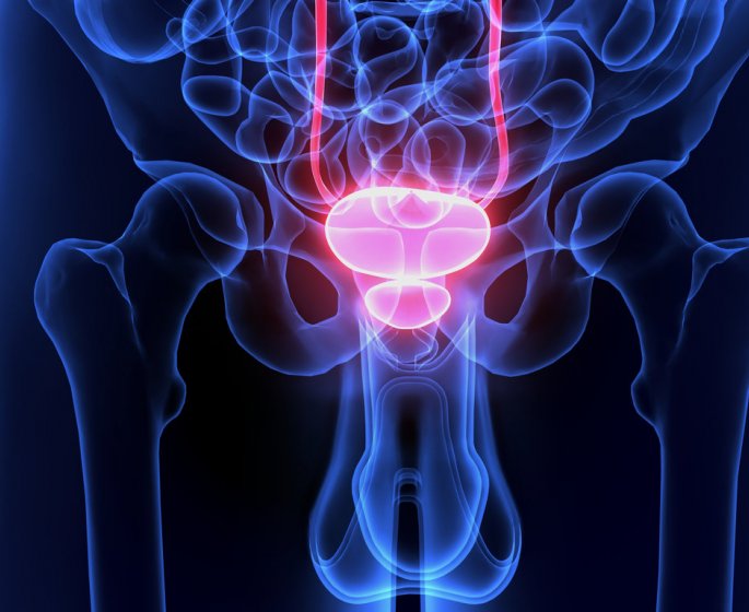 Adenome de la prostate : traitements, symptomes, causes, complications