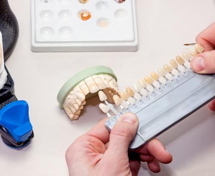 Les protheses dentaires fixes sur implants