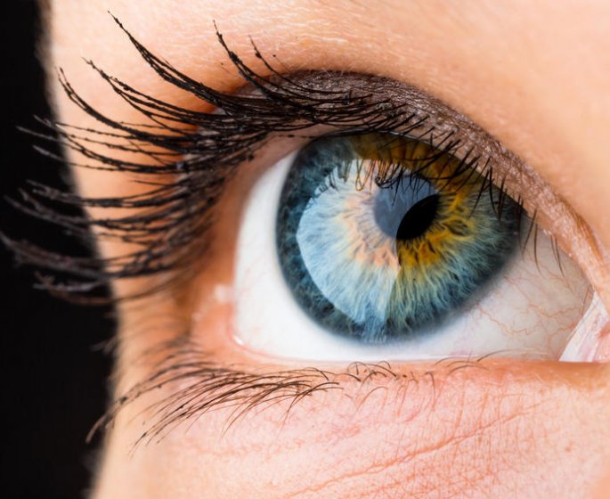 Recidive de cataracte : les symptomes
