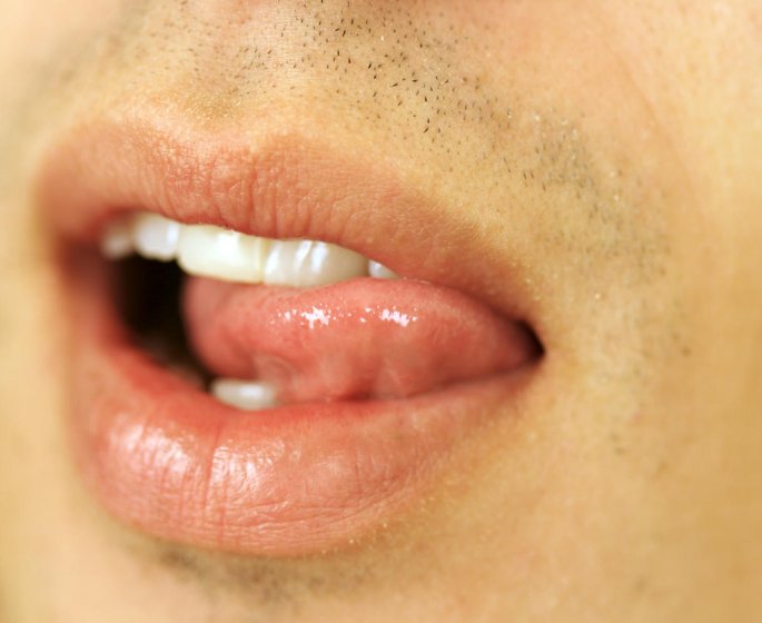 Inflammation de la langue : reconnaitre une glossite