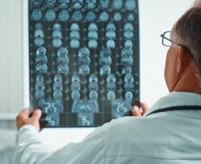 La maladie d-Alzheimer peut-elle etre transmissible ?