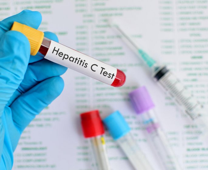 Neuf questions sur l’hepatite C