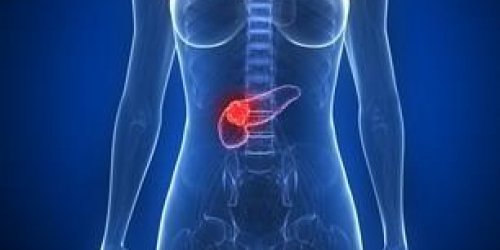 Cancer du pancreas : bientot un traitement pour le soigner en 1 semaine ?