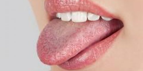 Que revele votre langue de votre sante ?