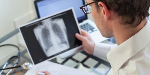 Cancer du poumon : “Ces signes auraient du m’alerter”