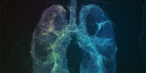 Cancer du poumon : obesite et surpoids pourraient augmenter le taux de survie