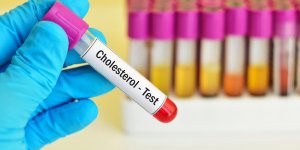 Cholesterol HDL eleve : est-ce que c-est grave ?