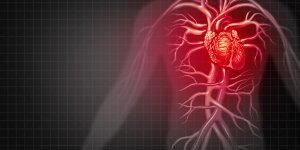 Pourquoi le cholesterol serait-il un facteur de risque d-infarctus ?