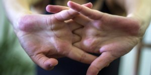 Arthrose : faire craquer ses doigts augmente-t-il le risque ?