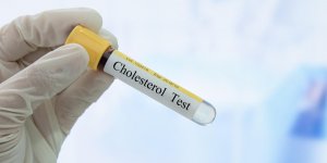Hypercholesterolemie familiale : la definition
