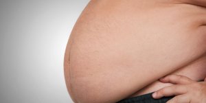 Gros ventre chez l-homme : 3 maladies en cause