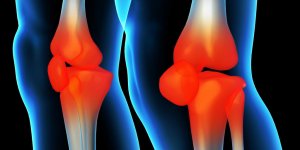 Mal au genou : peut-on reparer le cartilage du genou ?