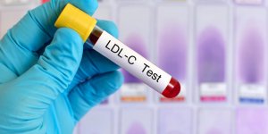 Cholesterol : que veut dire LDL-C ?