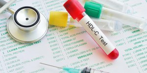 Cholesterol HDL : le bon ou le mauvais cholesterol ?
