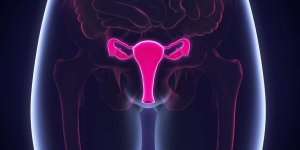 Cancer de l-ovaire : une evolution possible vers le peritoine